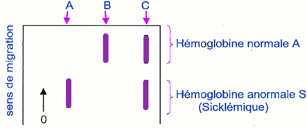 migration hemoglobine